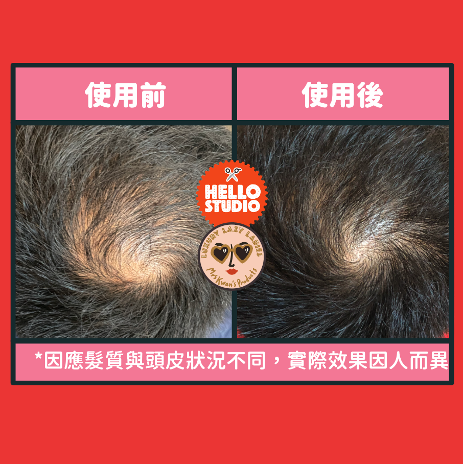 天然防脫髮長白山人蔘生薑洗頭水 400ml